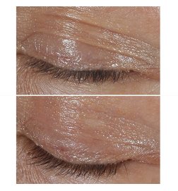 Smart Clinical Repair - Wrinkle Correction Eye Cream Smart Clinical Repair - Wrinkle Correction Eye Cream